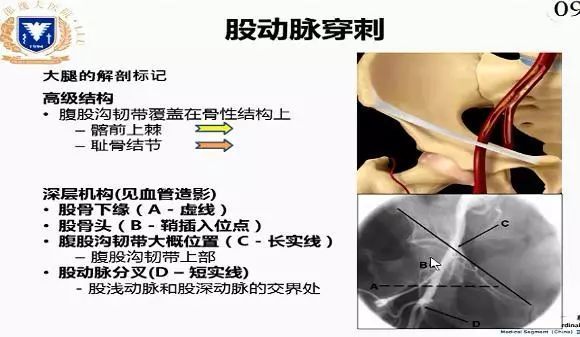 _造影程序_造影流程以及注意事项