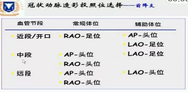造影流程以及注意事项_造影程序_