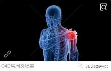 葛根桂枝汤颈椎病_颈椎病桂枝加葛根汤_