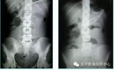 _影像科诊断医师_影像学诊断技术