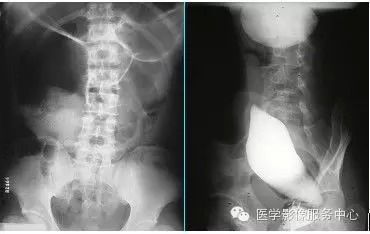 影像科诊断医师_影像学诊断技术_