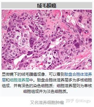 肿瘤滋养细胞的特点_滋养细胞肿瘤_肿瘤滋养细胞有哪些