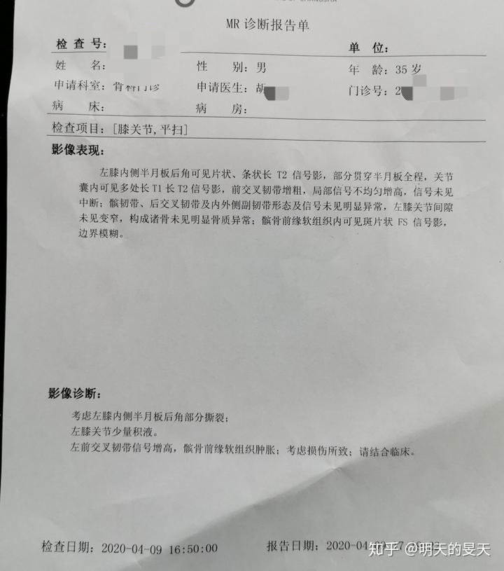 半月板3级撕裂--已关节镜手术