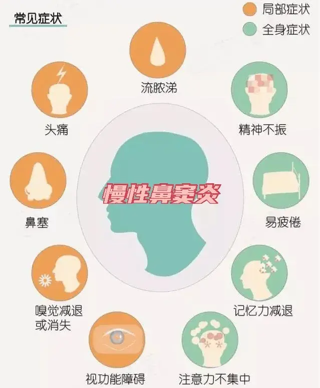 过敏性鼻炎有没有祖传秘方_古代怎么治过敏性鼻炎_