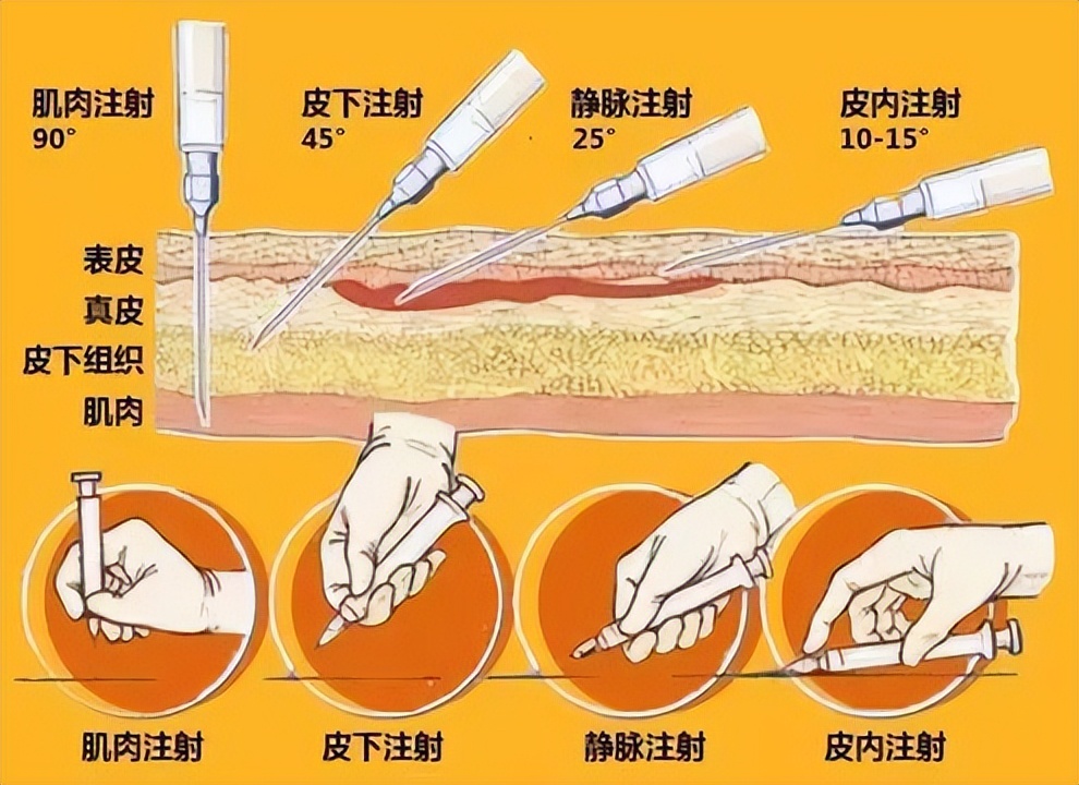 针剂去皱_打去皱针_扎去皱针