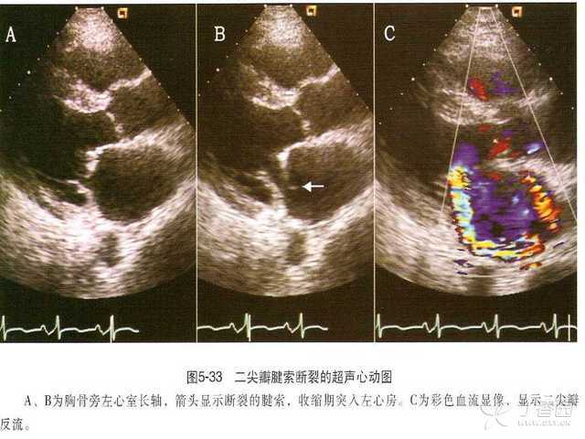 心动过缓怎么办__心动过速用什么药