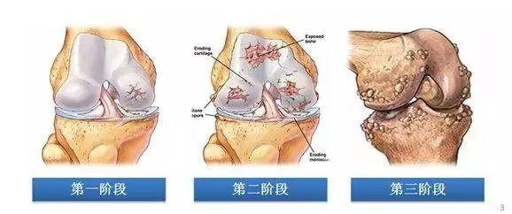 老年人腿疼有什么好处_老年人腿疼_请你播放老年人腿疼是怎么治疗