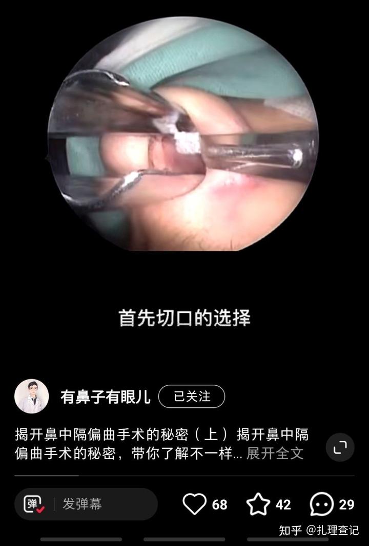 血痂快速去除的方法_血痂什么意思_血痂