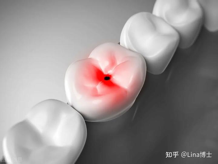 硬物堵在马桶弯道里怎么办_硬物掉进蹲厕怎么办_硬物